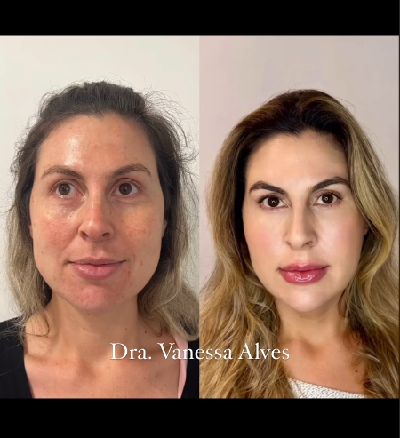 Antes e depois — Patrícia M., 42 anos