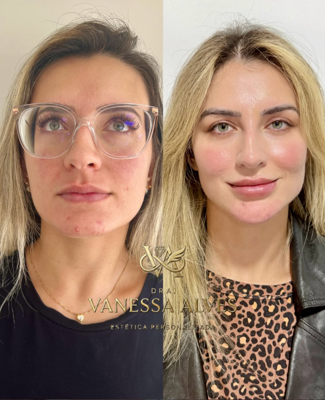 Antes e depois — Camila R., 34 anos